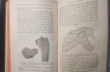 Photo of old science text book showing bones
