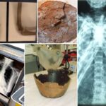 Montage photograph of x-ray images